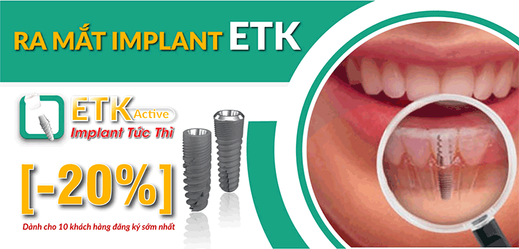 Ưu Đãi 20% Cấy Ghép Implant ETK Active -2